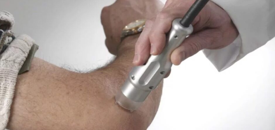 Treatment of psoriasis with a laser